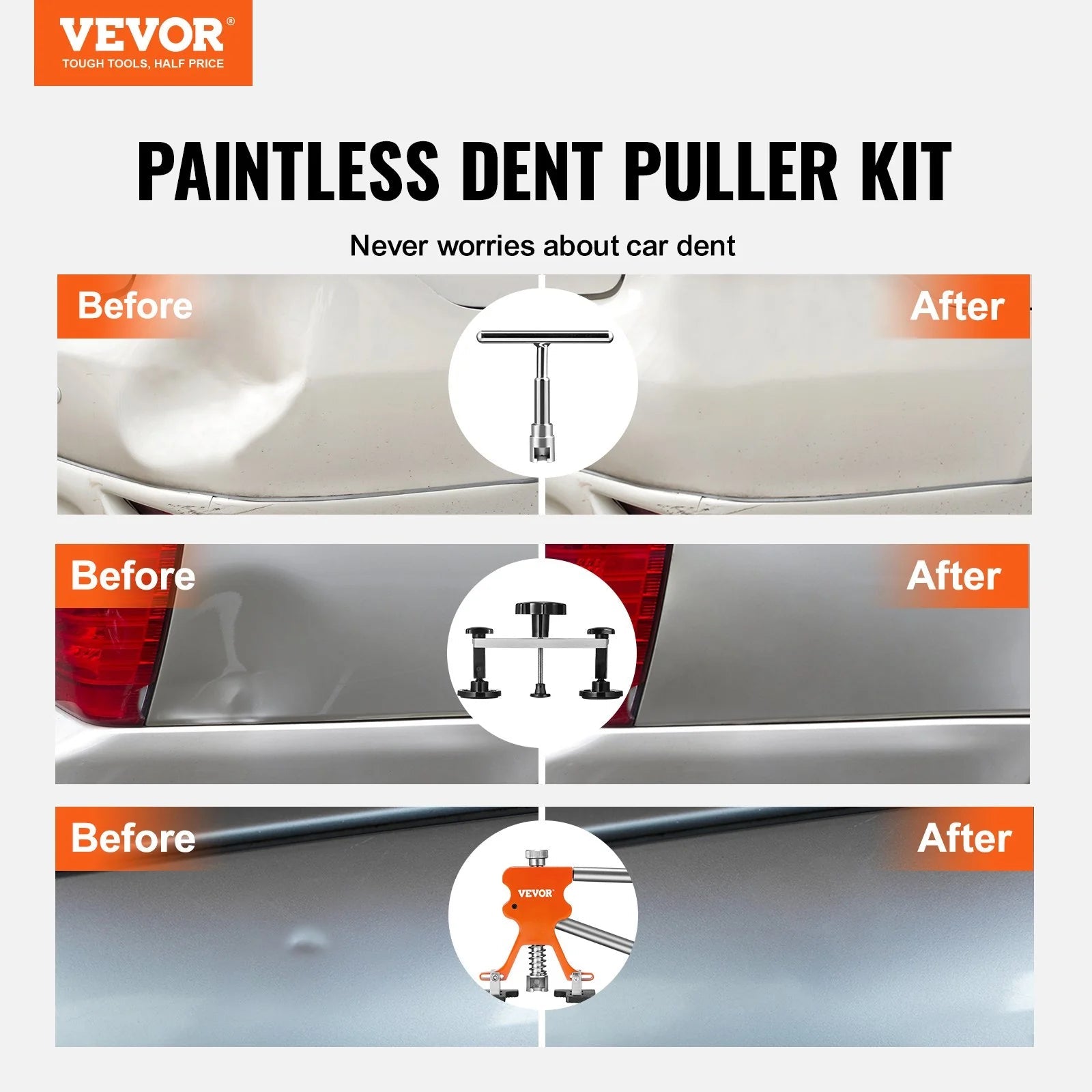 VEVOR Car Body Dent Puller Bridge Lifter Tool Paintless Hail Remover Repair Kit - Revved Up Auto
